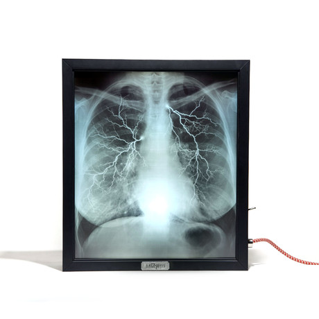 Mentalpieces X-Ray Lightbox // Internal Medicine