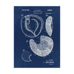Baseball Mitt, 1941 // Blue II (18"W x 24"H // Print)