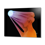 Overexpressed // Aluminum