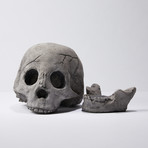 Hollow Human Skull