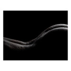 Dark butt (12"W x 8"H x 0.2"D)