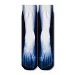 Crew Socks // X-Ray Toes