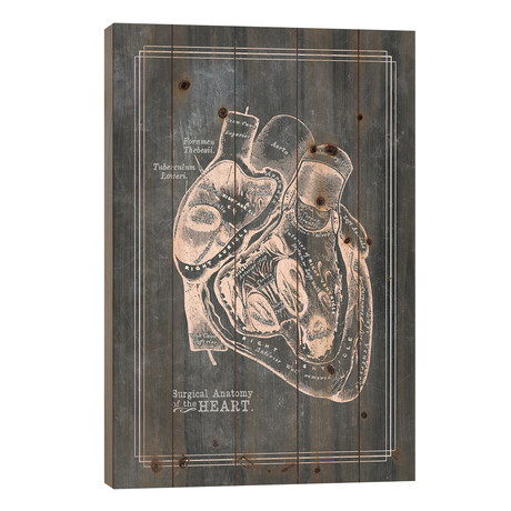 Surgical Anatomy Of The Heart by ChartSmartDecor