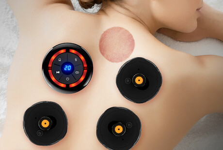 Improve Your Health With Cupping