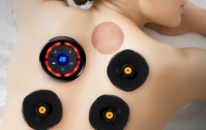 UBALANCE Smart Cupping Set